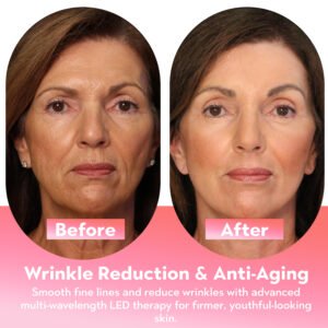   TX 4D LED Light Therapy Mask | Professional Home Skincare