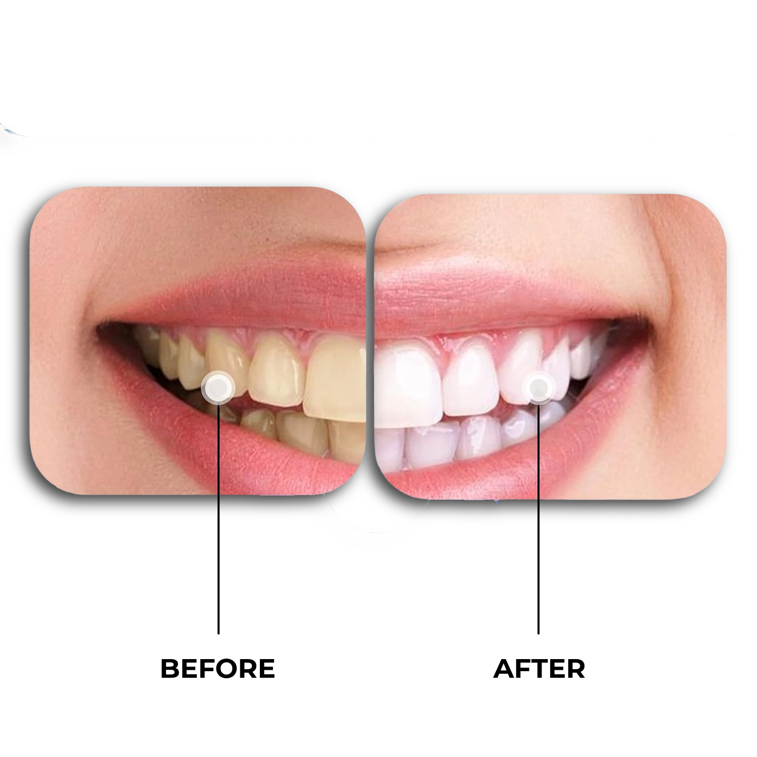 50700043362954 Trendlox TR40 Wireless LED Teeth Whitening Kit