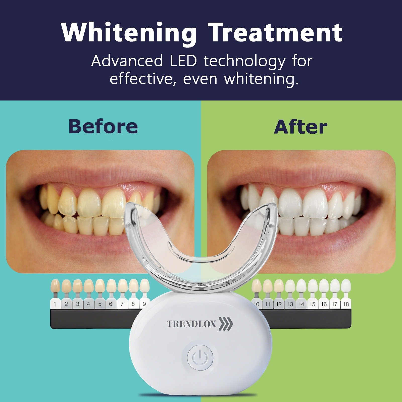 Teeth3 TR12 LED teeth whitening kit trendloxcom